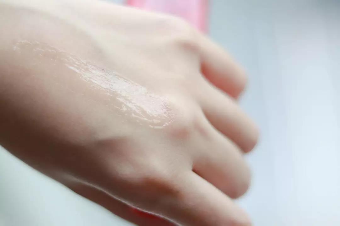 澳洲木瓜膏可以祛痘消炎吗,木瓜膏祛痘疤