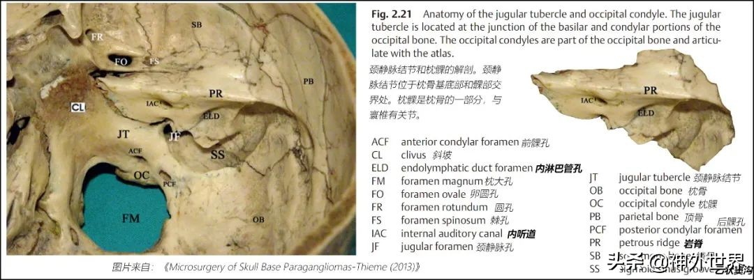 颞骨解剖,颞肌解剖讲解