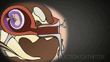 缺乏性教育,中国缺乏性教育