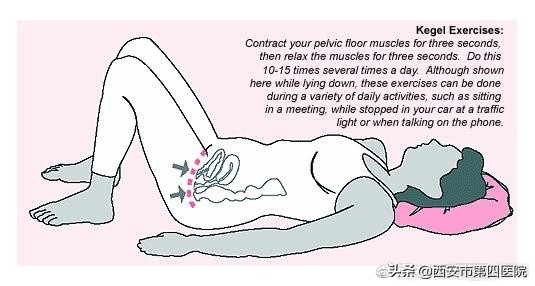 产后骨盆底肌训练方法,中医产后康复适宜技术培训