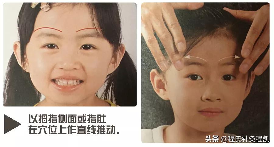 上呼吸道感染引起的感冒怎么用药,治疗感冒小妙招小孩