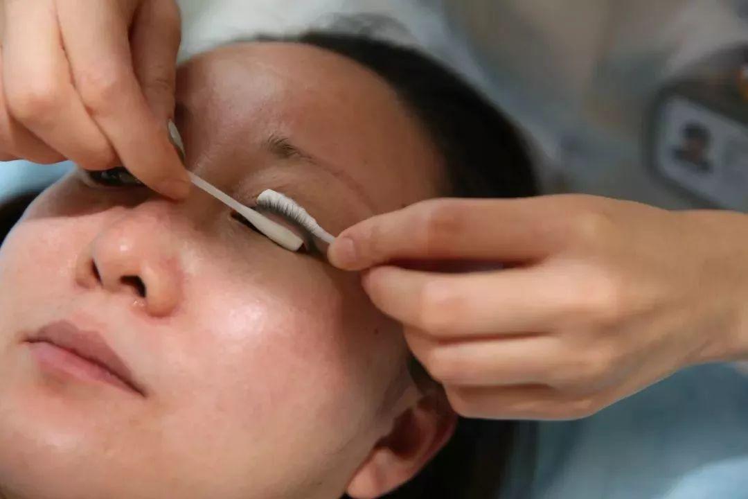 春季卡他性结膜炎影响视力,春季卡他性结膜炎眼睑有异物感