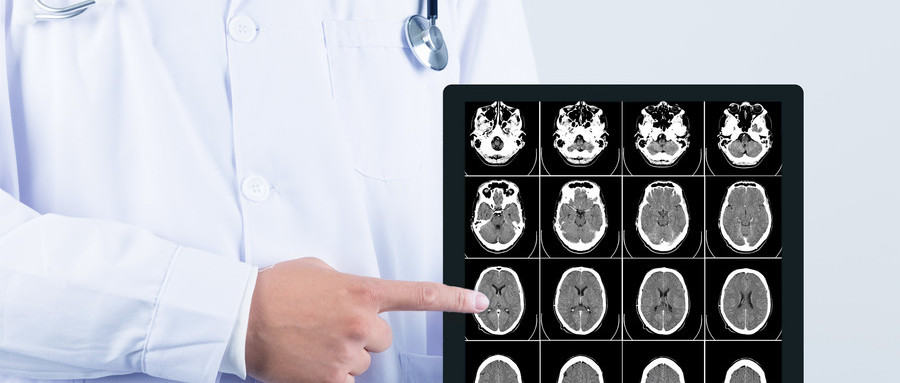 神经痛难忍怎么办,神经痛怎么办最快止痛方法