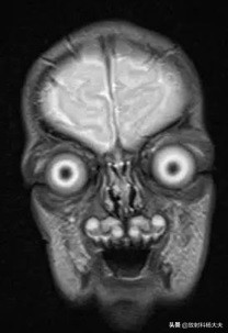 放射科趣味图片,放射科亮点图片