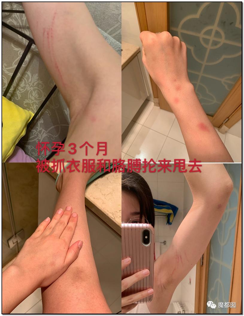 短跑名将张培萌被曝家暴,短跑名将张培萌殴打岳母被行拘