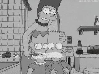 楔状缺损坑,较深的楔状缺损