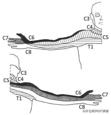 骨折做完手术注意哪些事项,骨折以后做手术以后需要注意什么