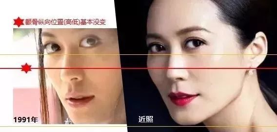 如何把法令纹变成一件高级的事