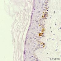 皮肤干燥脱皮10分钟清晨急救法,皮肤干燥尤其是秋冬会全身脱皮