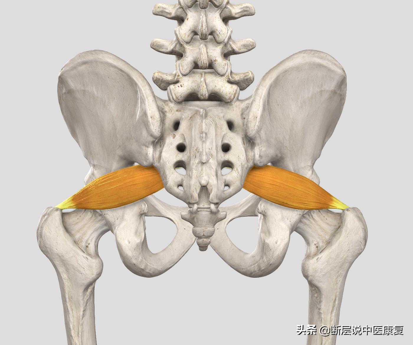 怎样才能治好梨状肌综合征,如何治疗梨状肌综合征