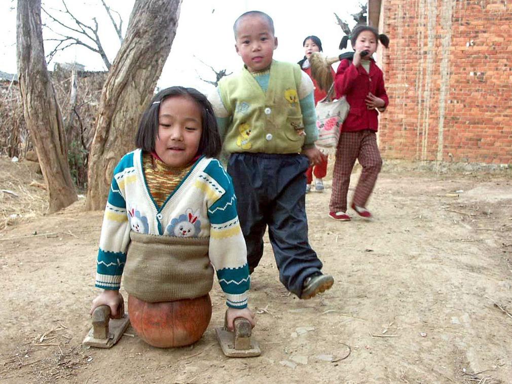 “篮球女孩”云南姑娘，4岁因车祸高位截肢，20年过去她怎么样了