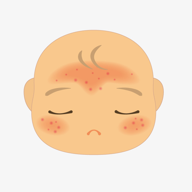 小孩身上起湿疹能用艾叶水洗么,孩子脸上起湿疹可以沾水吗