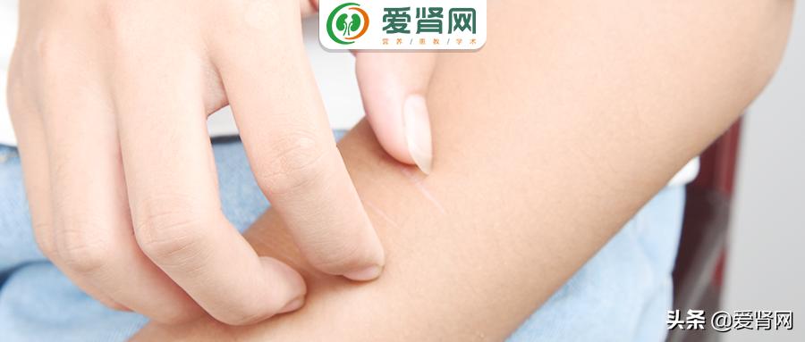 肾友缓解皮肤瘙痒最全方案，真的不要错过本文
