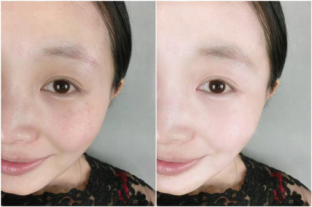 精华液排行榜前十名小蓝瓶薇诺娜,精华液推荐平价补水淡斑抗初老