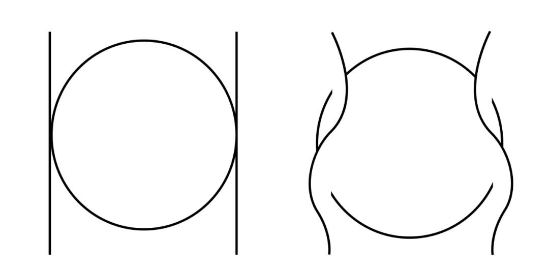 肉脸怎样改善脸型变好看,脸上肉多改善脸型