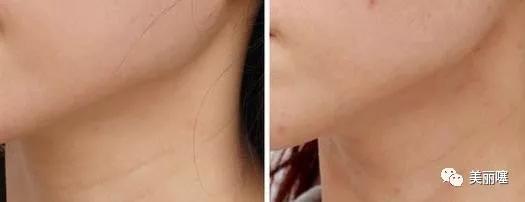 屈臣氏吐槽健康产品,屈臣氏兰蔻粉水是正品吗