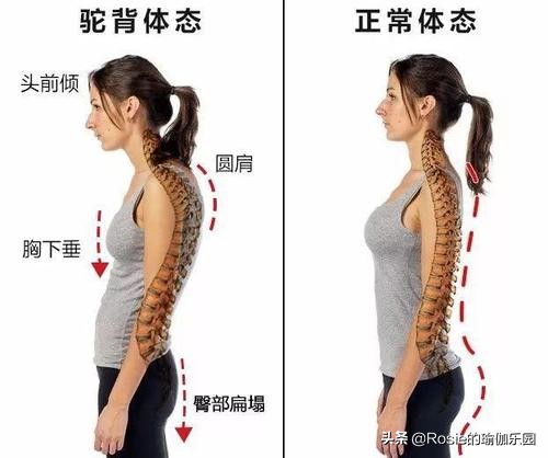 驼背肚子突出胸下垂怎么纠正姿势,弯腰驼背导致胸部外扩下垂怎么练