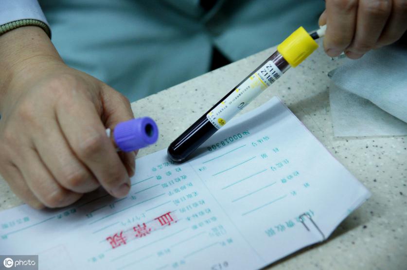 尿液化验单潜血3+是什么参考范围,化验单没有参考范围怎么看