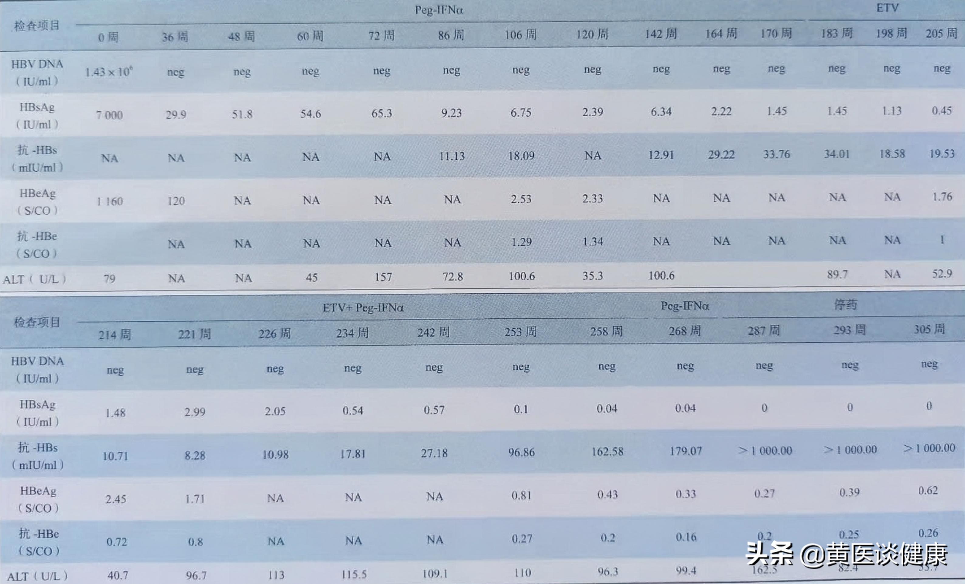 长期抗病毒治疗有什么副作用,干扰素抗病毒治疗有用吗