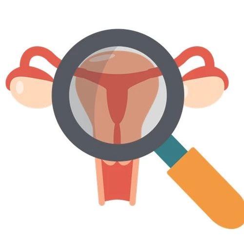 辟谣：宫腔镜检查真的有那么可怕么？仔细看完别被坑了