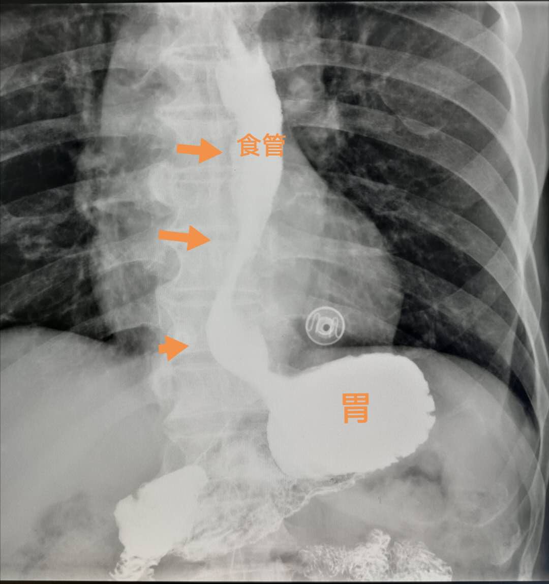 过年喝酒小酌怡情莫要贪杯,春节喝酒喝多了想吐怎么办