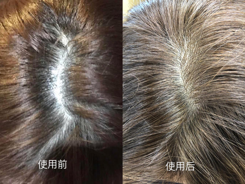 秃头少女的救星洗发水老国货,秃头女生的救星