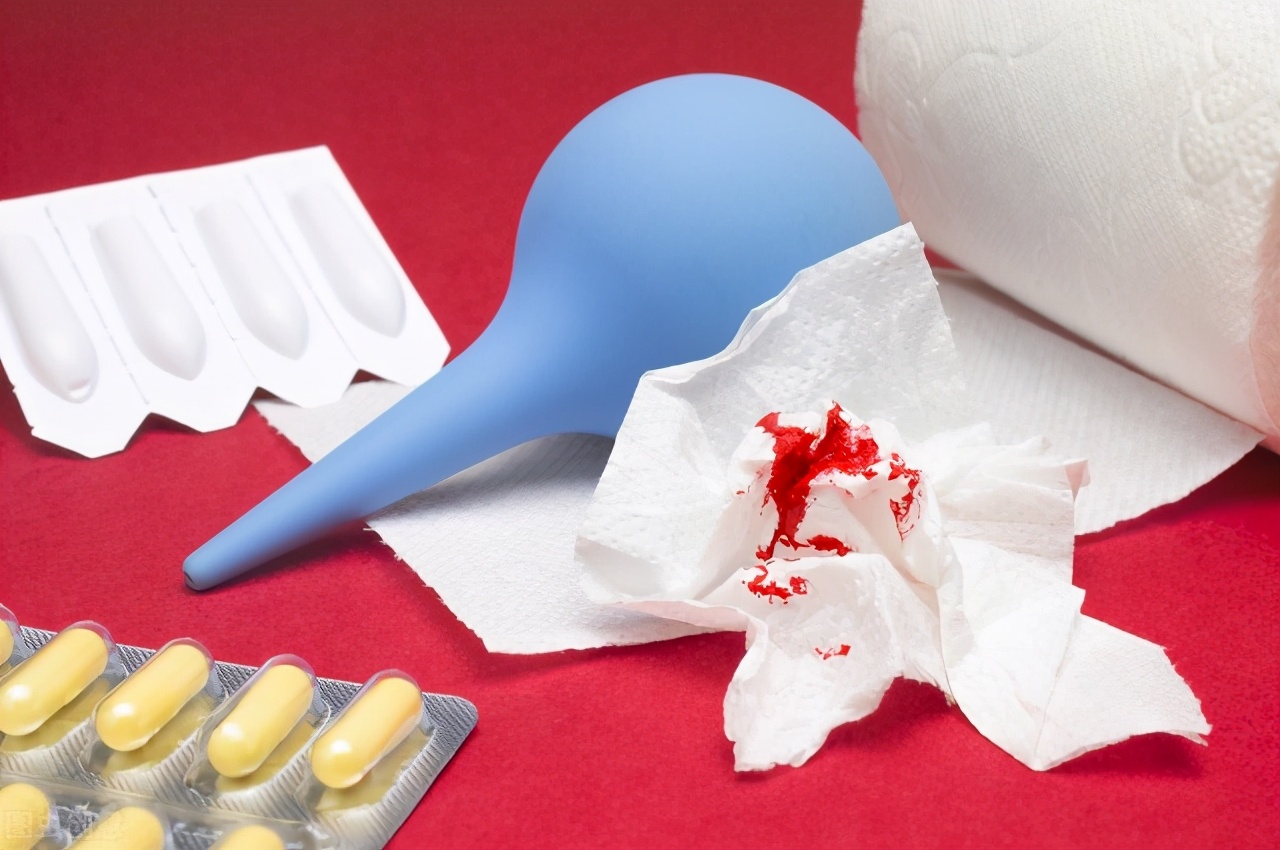 痔疮如何治疗倪海厦,痔疮如何治疗