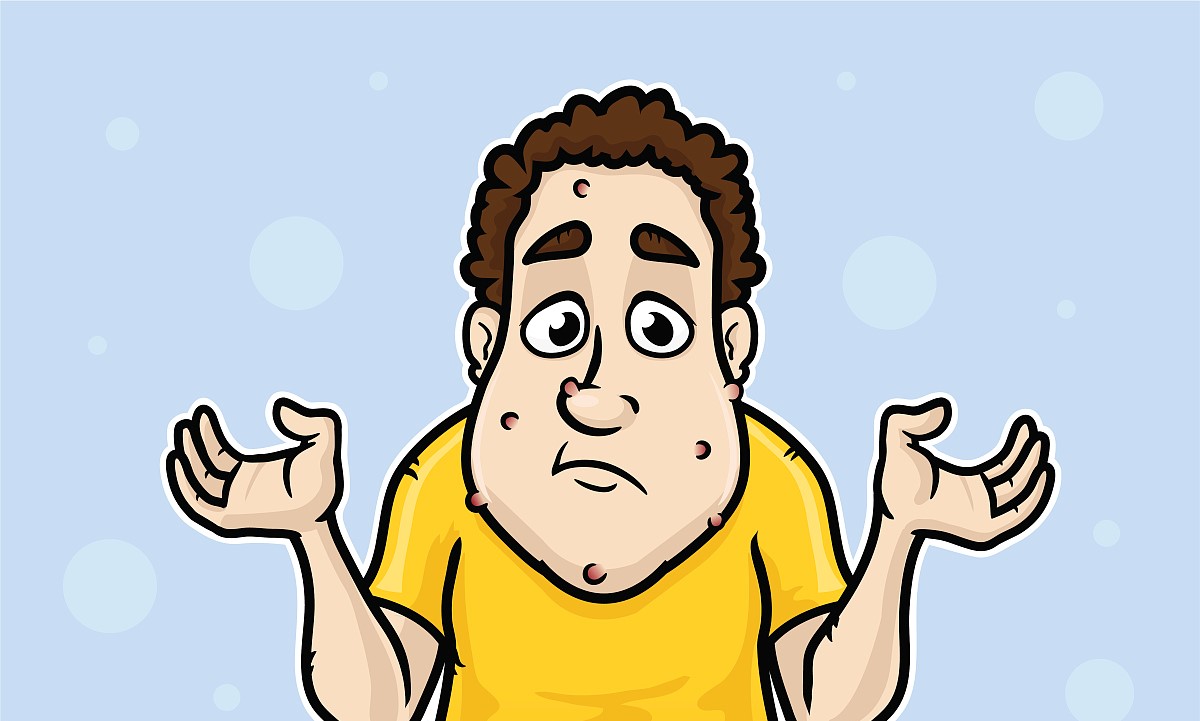 激素依赖性皮炎西医能治好吗,激素药导致皮肤毛细血管扩张