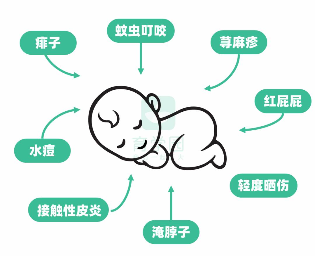 炉甘石什么皮肤病不能用,炉甘石没有副作用吗