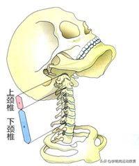 富贵包怎么消除最好方子,富贵包怎么消除视频教学