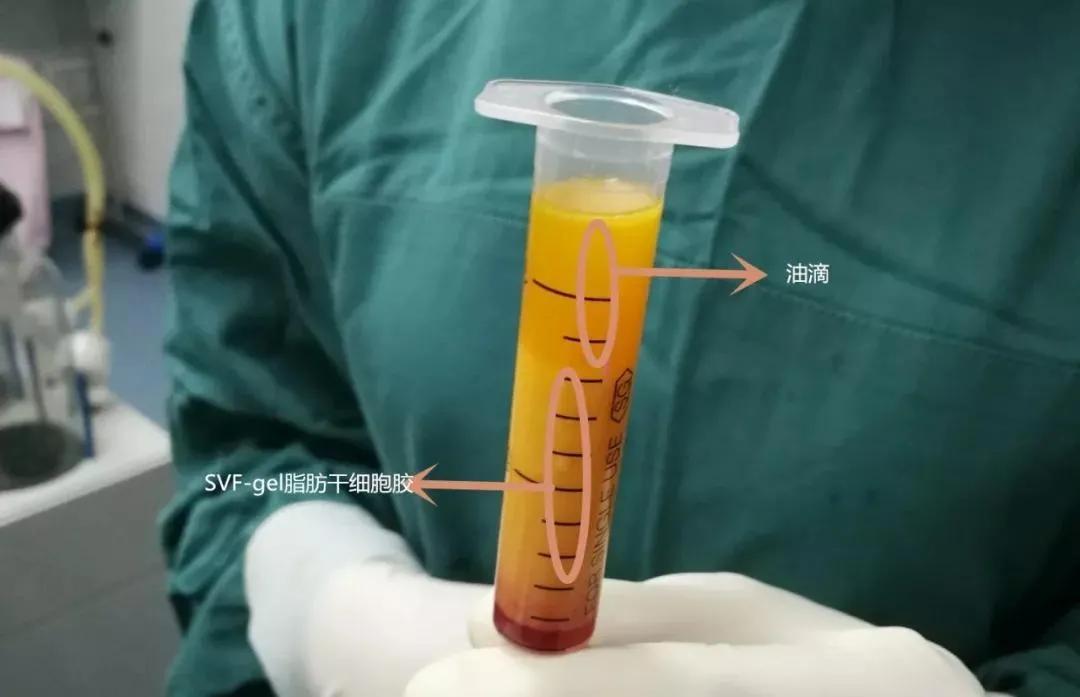 女生运动瘦不下来,女人运动瘦不下来怎么回事