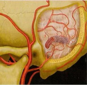 科普如何正确认识耳鸣,科普文的趣味性
