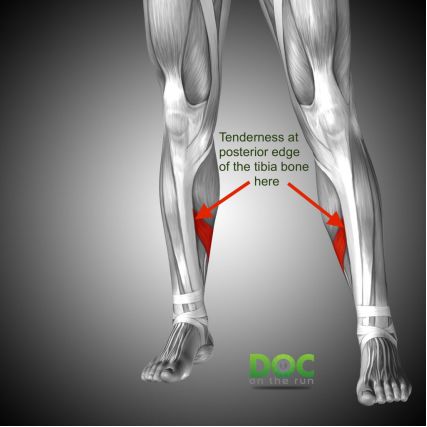 跑者小腿疼痛如何解决,初跑者小腿酸痛如何正确的跑步