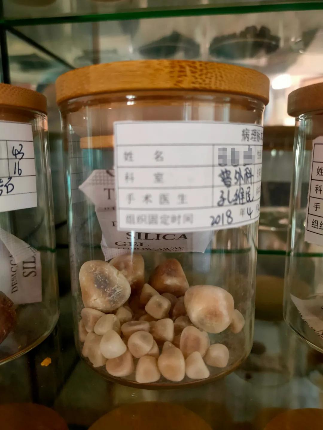 曲靖中医医院微创,曲靖市中医医院微创技术怎么样