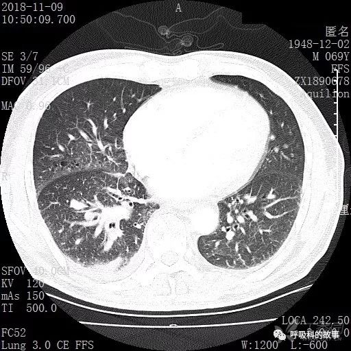 怎么应用统计学做调查,统计学方法可以解决的主要问题