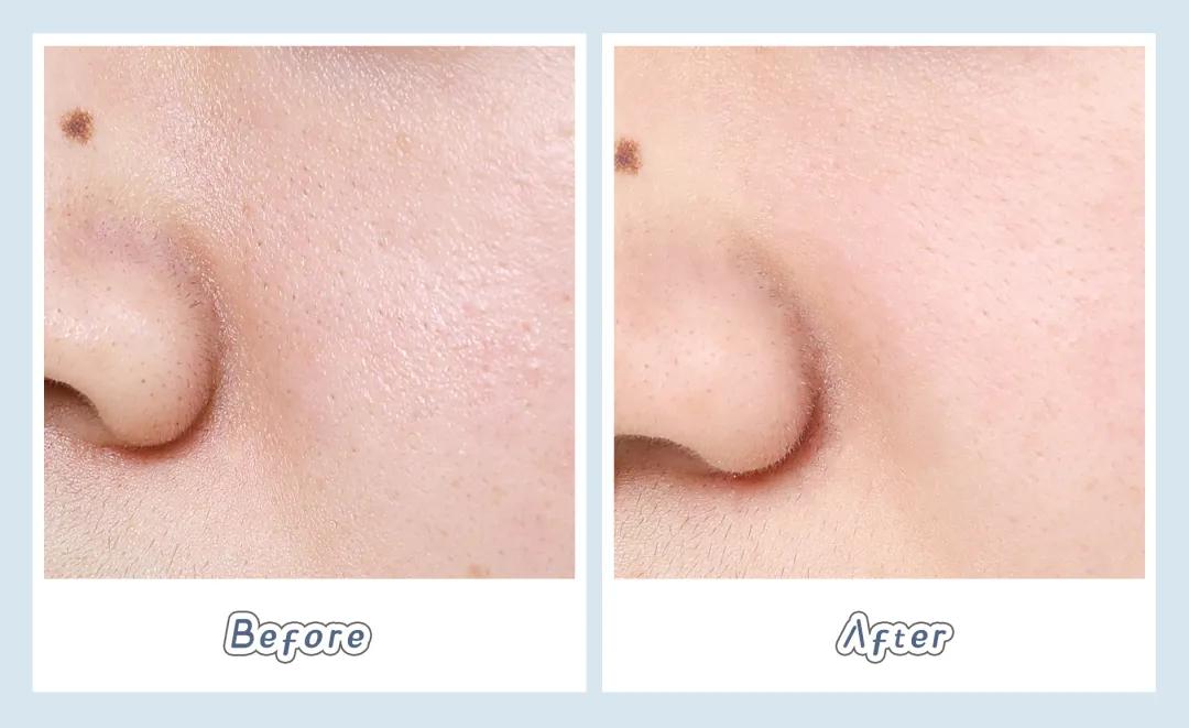 homefacialpro清洁面膜,6款超火清洁面膜测评