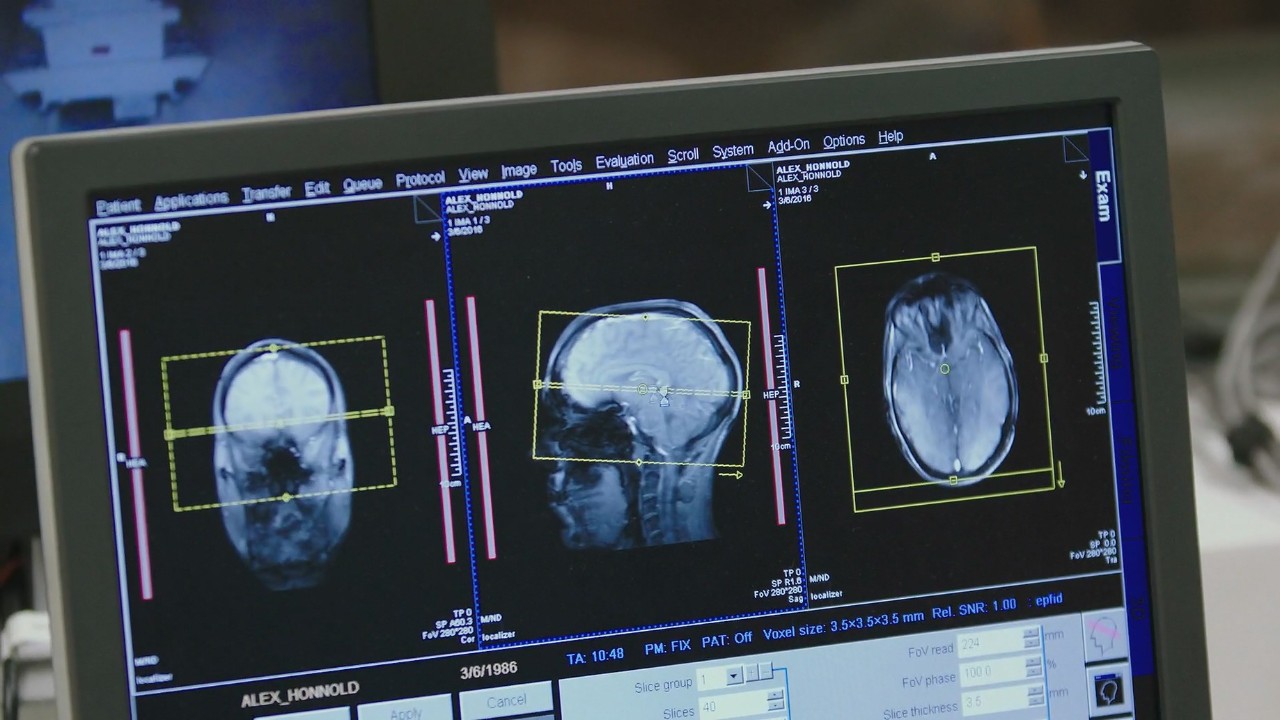 无保护攀岩世界纪录,吉尼斯纪录攀爬酋长岩