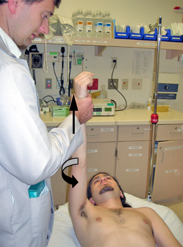 骨科脱臼恢复手法视频,肩膀脱臼骨折保守治疗