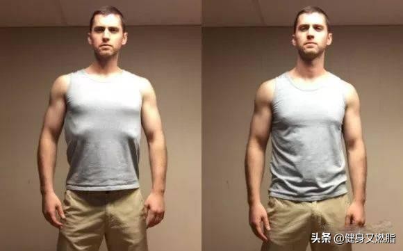 什么是肋骨外翻与正常对比,肋骨外翻不矫正有什么影响