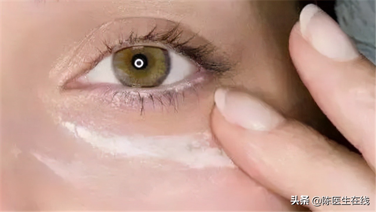 眼周脂肪粒去除方法是真的吗,眼下有脂肪粒怎么根除不复发