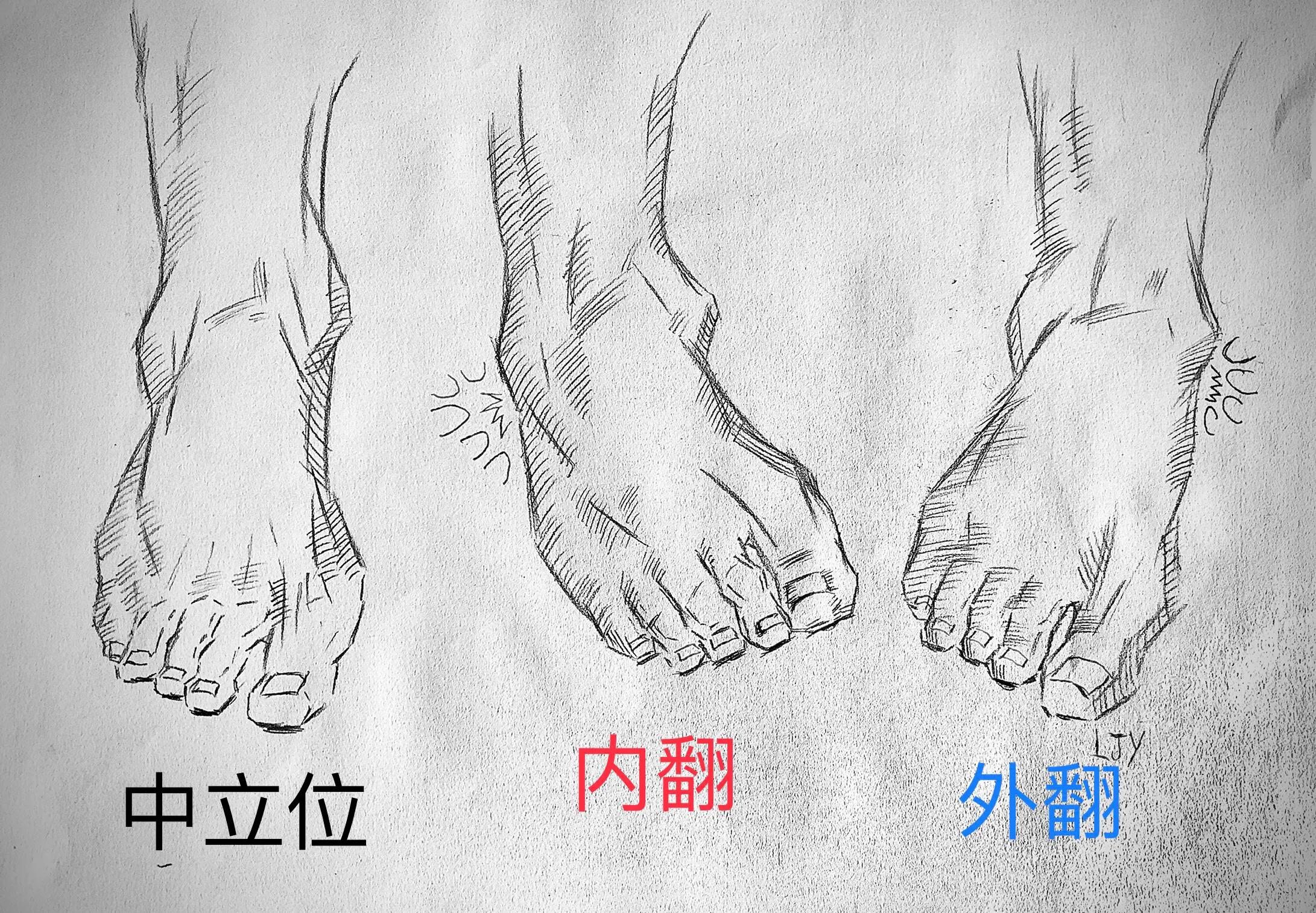 踝关节扭伤后有何表现,踝关节扭伤的自我判断与治疗