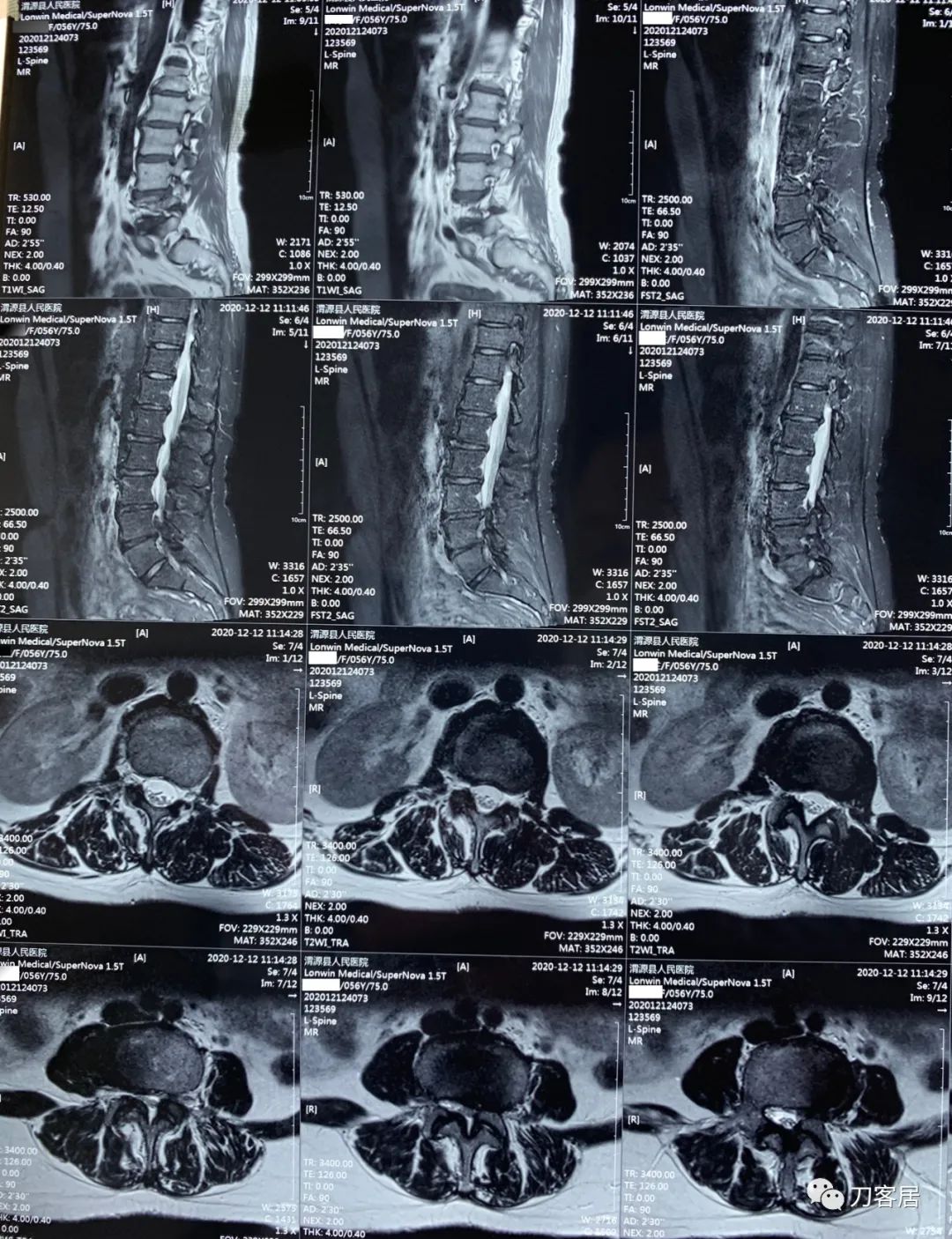 我的门诊病历,我的门诊