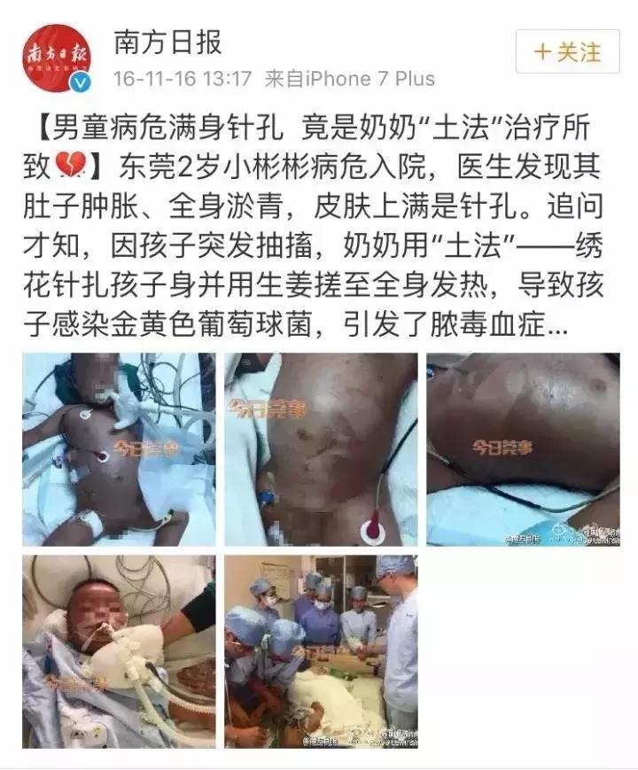 儿科偏方大全100个,民间偏方害惨小孩