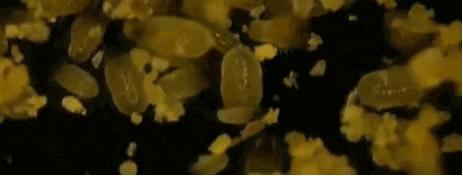 头皮屑多怎么根除最简单方法,如何彻底根治头皮屑的方法