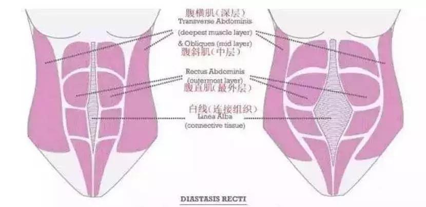 生娃后肚子凹下去,生完宝宝肚子大自己能恢复吗