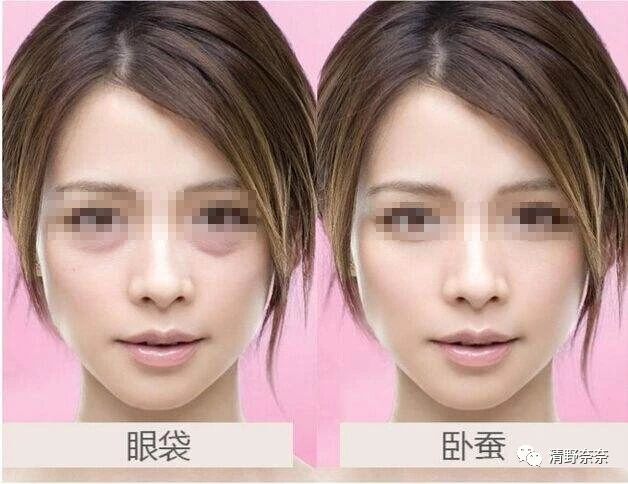 解决眼部干纹黑眼圈最好的方法,黑眼圈眼袋干纹怎么消除