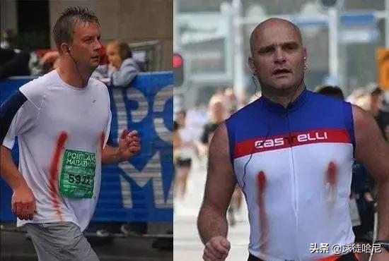马拉松运动员突发状况要怎么办,马拉松跑出瘀血怎么处理