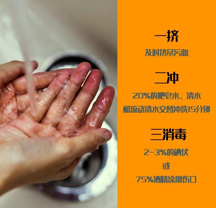 被狗舔了裤子不洗会感染狂犬病吗,被什么狗咬伤会得狂犬病