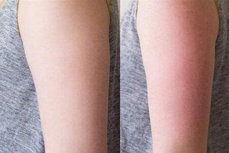 孙俪普拉提瑜伽,孙俪每天必练瑜伽动作