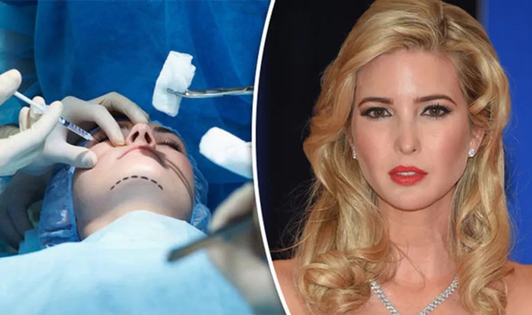 伊万卡有没整容,伊万卡有整容吗